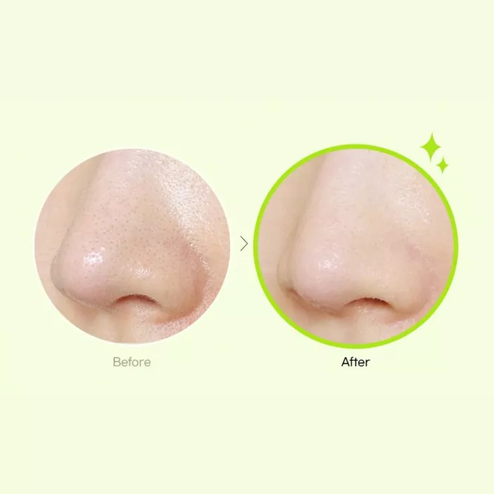 Ulei de curatare a tenului Apple Cider Deep Cleansing pentru pori, machiaj, sebum si puncte negre, (200ml), Ariul