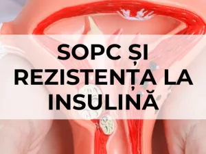 SOPC și rezistența la insulină SOPC și rezistența la insulină