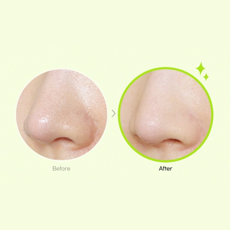 Ulei de curatare a tenului Apple Cider Deep Cleansing pentru pori, machiaj, sebum si puncte negre, (200ml), Ariul