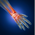 Sistem osteo-articular